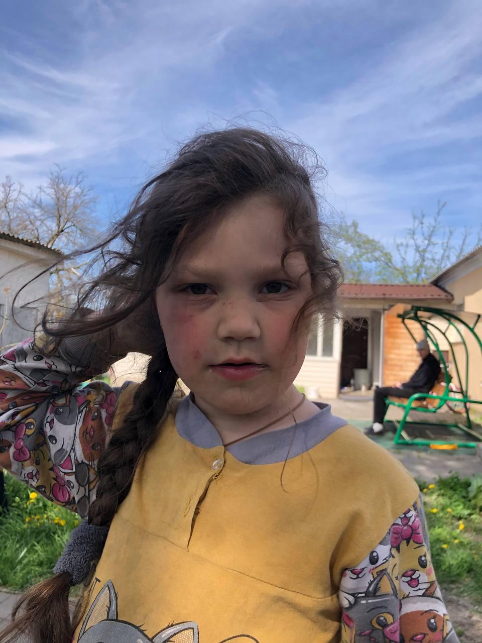 Mädchen Haus Rukavitschka in der Ukraine